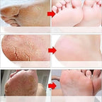 Moisturizing Foot Peel Mask for Cracked Dry Feet – Goat Milk (2 Pack)