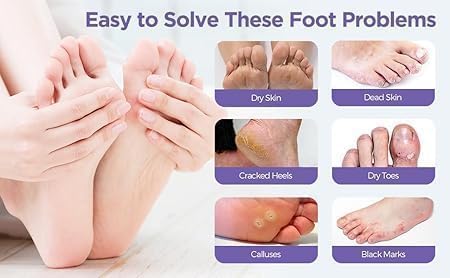 Moisturizing Foot Peel Mask for Cracked Dry Feet – Goat Milk (2 Pack)