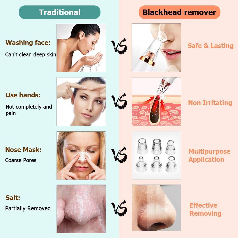 6-in-1 Blackhead Remover Vacuum | Electric Derma Suction Pore Cleaner for Face